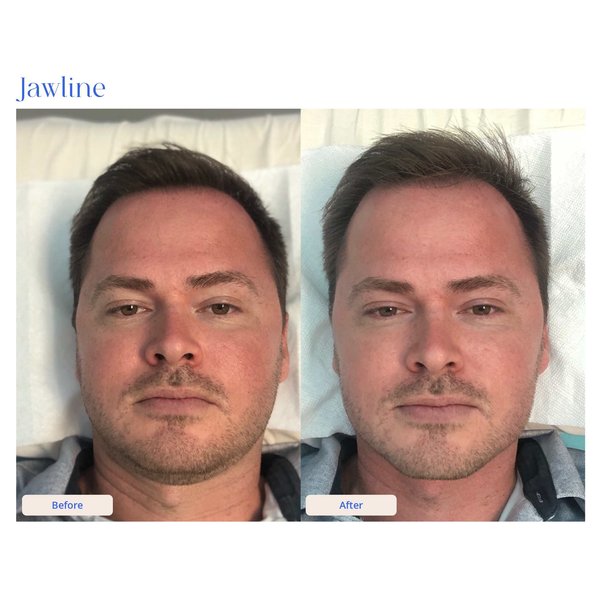 Before and After Result 12